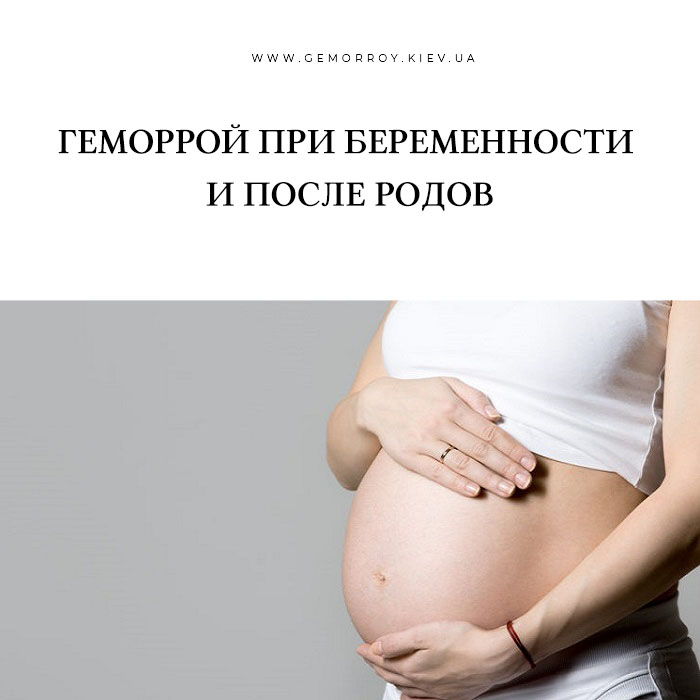 Чем лечить геморрой при беременности 3 триместр. Геморрой во время беременности. Как выглядит геморрой при беременности. Как выглядит геморрой во время беременности. Геморрой у беременных фото.